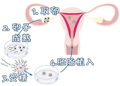 代生男孩机构